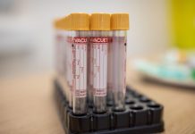 Brasil registra 921 novas mortes por Covid-19 no sábado