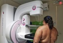 Delmiro Gouveia realiza mutirão de mamografias até a próxima quinta-feira, 09