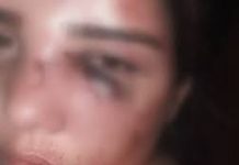 Mulher é agredida com socos e chicotadas no rosto; suspeito foi preso