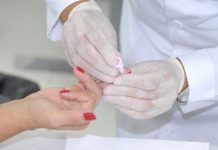 Alagoas registra 756 casos de HIV este ano