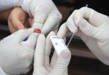 Arapiraca não registra óbitos confirmados por Covid-19 há mais de 10 dias, mas cuidados devem ser mantidos