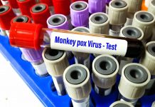 EUA registram 2 casos de varíola dos macacos em crianças pela 1ª vez